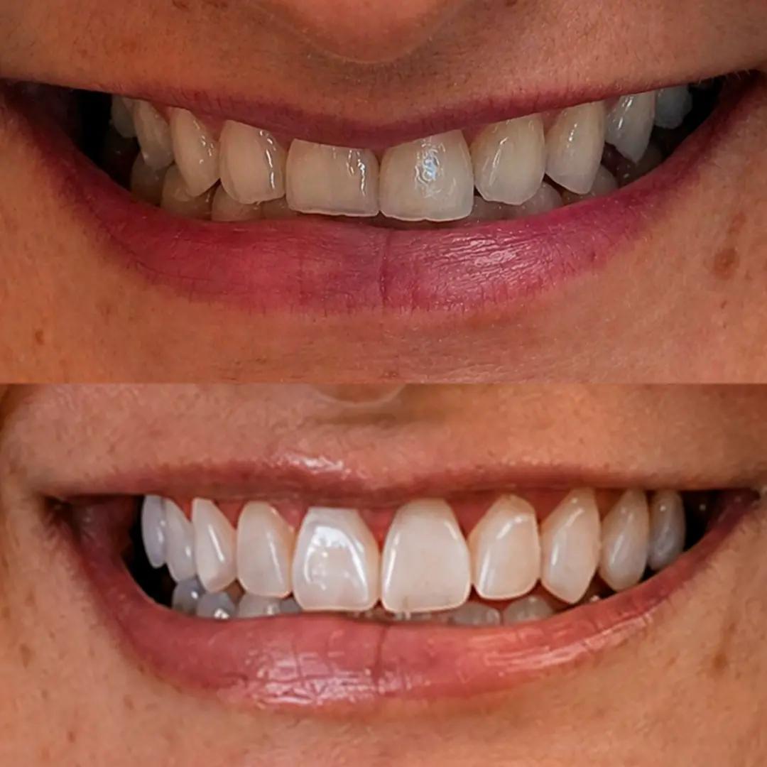 Caso 01 antes e depois